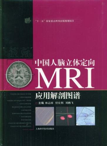 中国人脑立体定向MRI应用解剖图谱_075.pdf