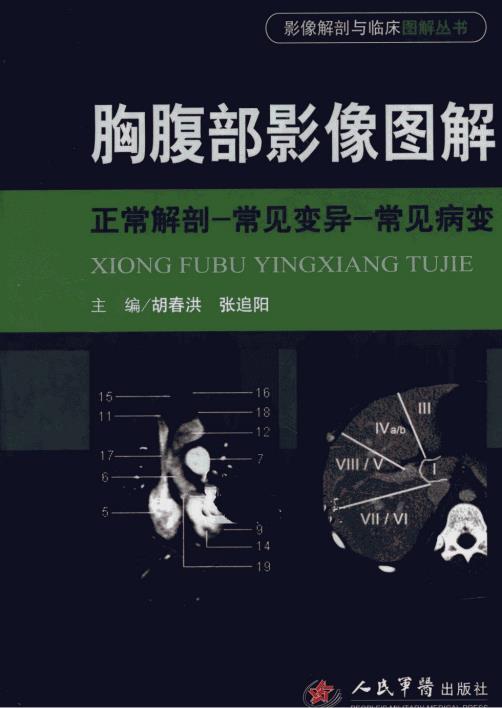 胸腹部影像图解  正常解剖-常见变异-常见病变-062.pdf